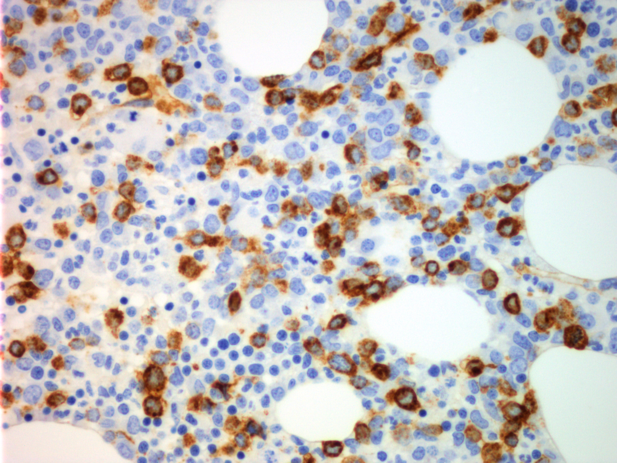 CD34 (high power)